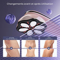 Appareil massage anti cellulite 6 têtes portable