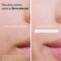 Épilateur lumière pulsée PL5157 tête précision rasoir inclus